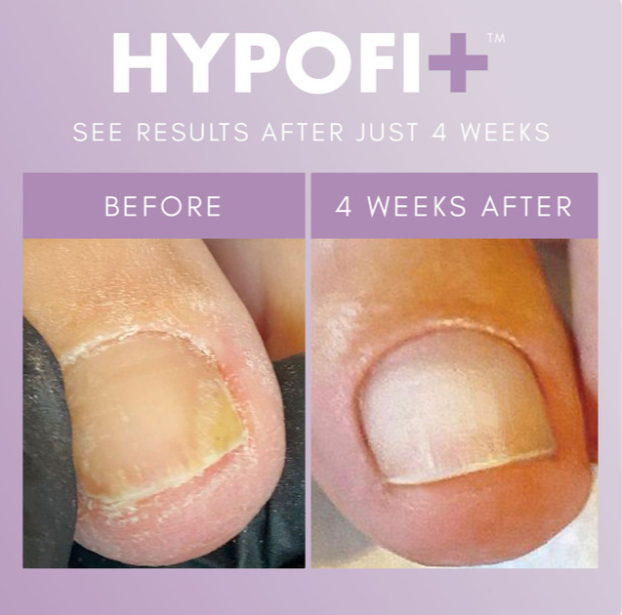 The GelBottle Hypofix™ Primer